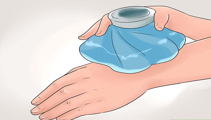 روش های خانگی برای درمان سوختگی